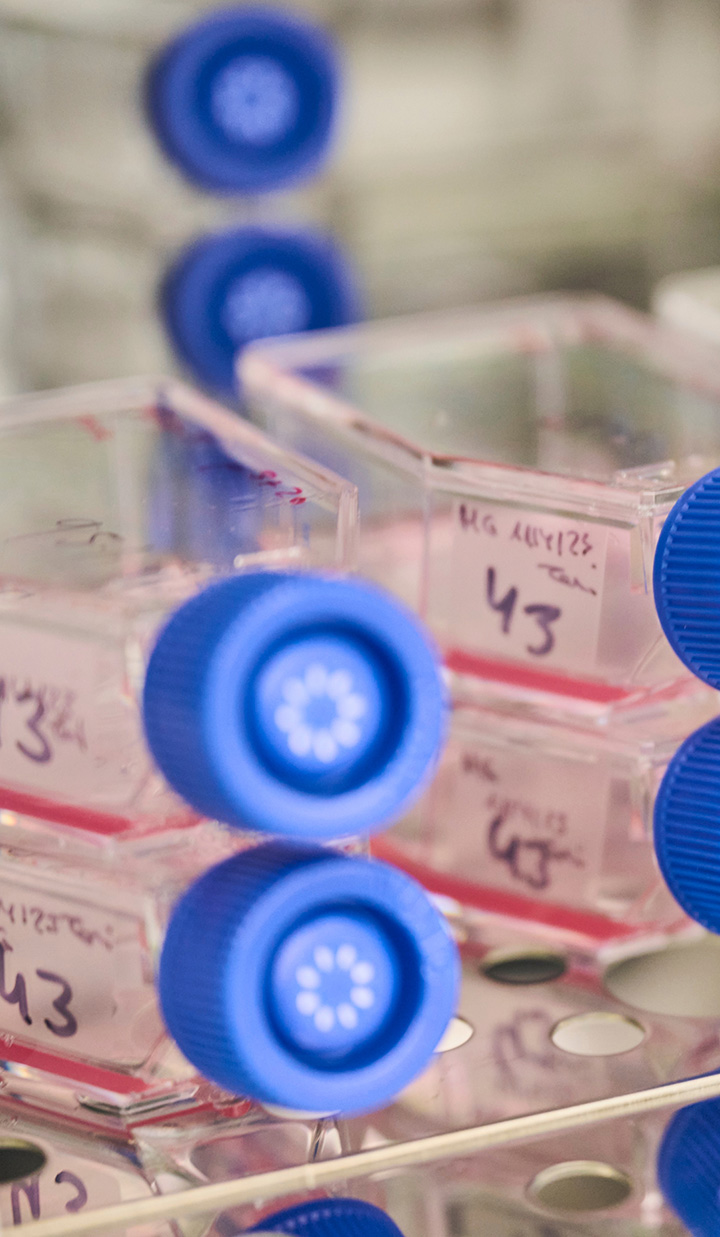 stack of laboratory flasks with blue caps containing liquid on metal shelf