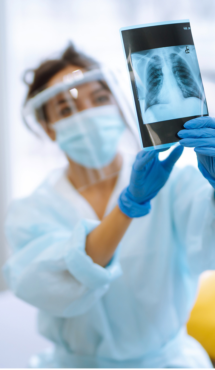 A healthcare worker wearing protective clothing and gloves holds up a chest X‑ray showing the lungs.