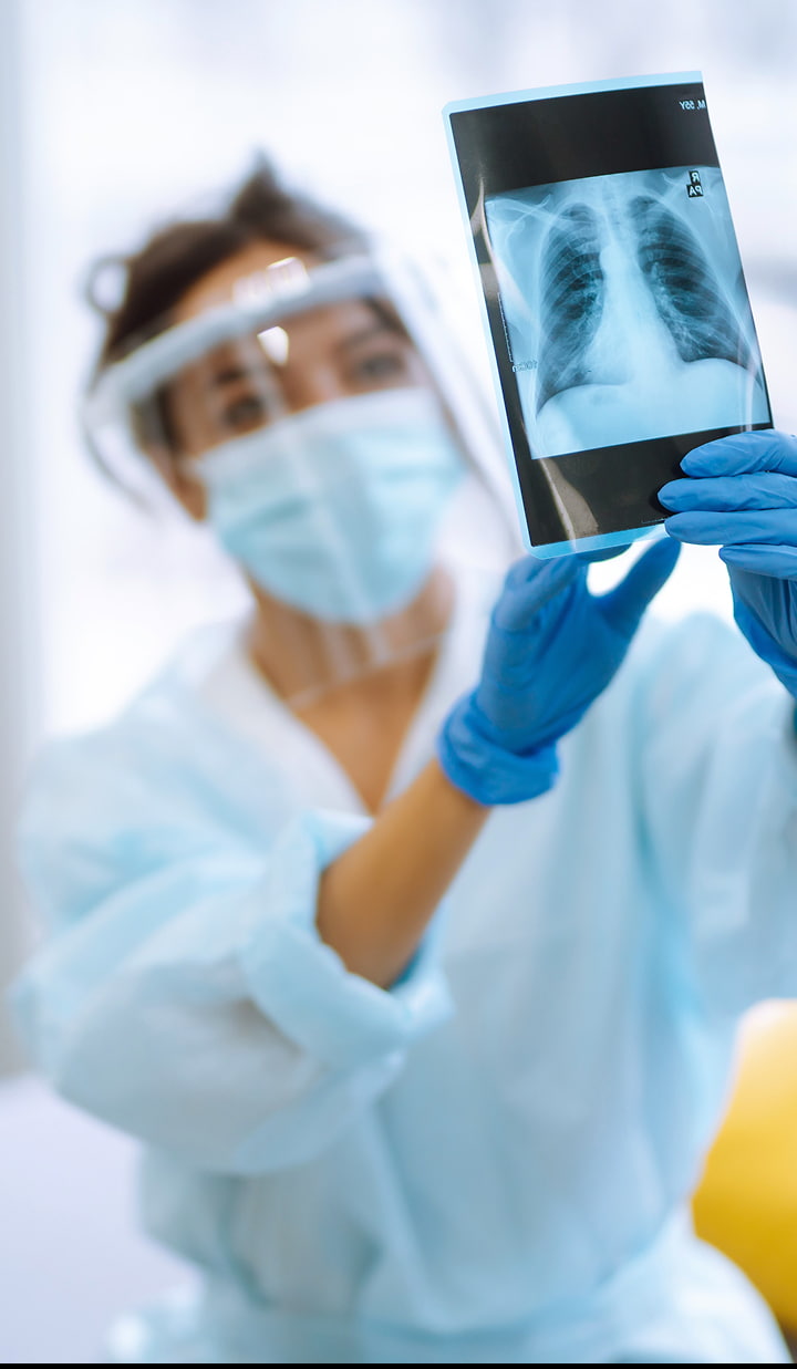 A person wearing protective medical clothing and blue gloves is holding up a chest X-ray image showing lungs.